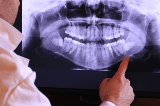 Best Emergency Treatment for Dental Infections or Abscesses in Goodland, KS